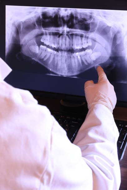 Best Emergency Treatment for Toothache in Converse, IN